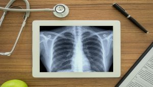 Apps for Taking X-rays Using Your Cell Phone